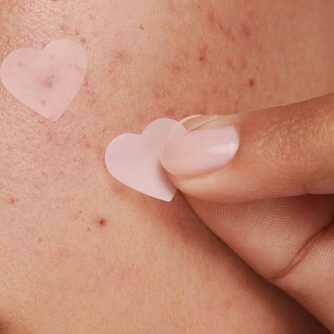DAPOP - Parches para acné efecto Uv - Pimple Patch