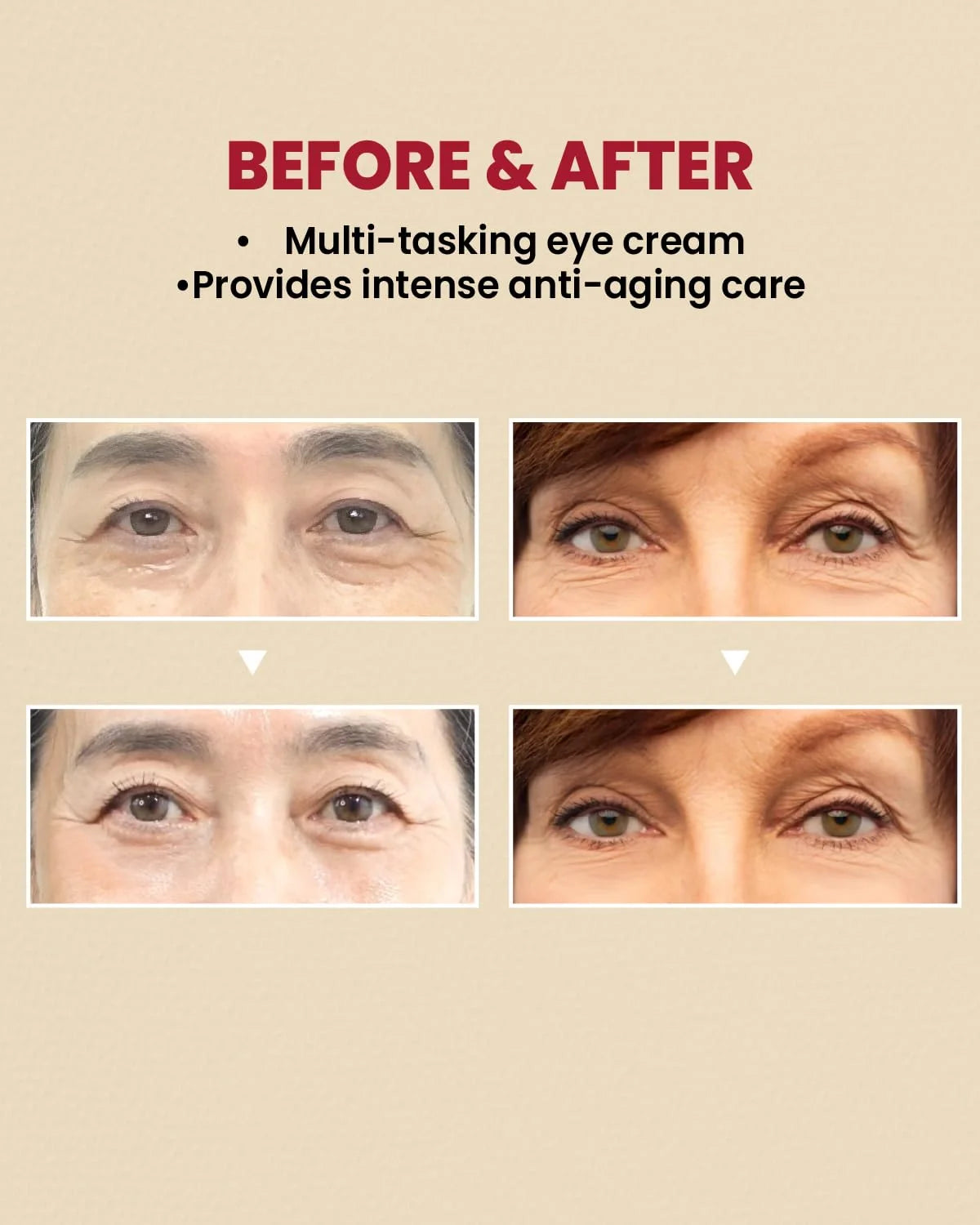 KSECRET SEOUL - 1988 Crema de Ojos: Liposoma Retinal 4% + Frijol Fermentado